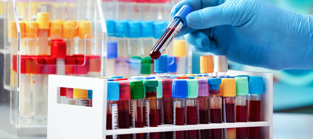 Hematología Completa